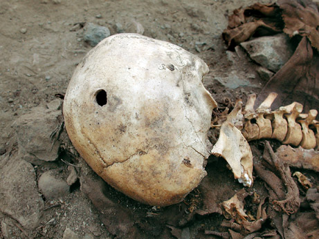 Inca killed by 16th Century Spanish Musket Ball