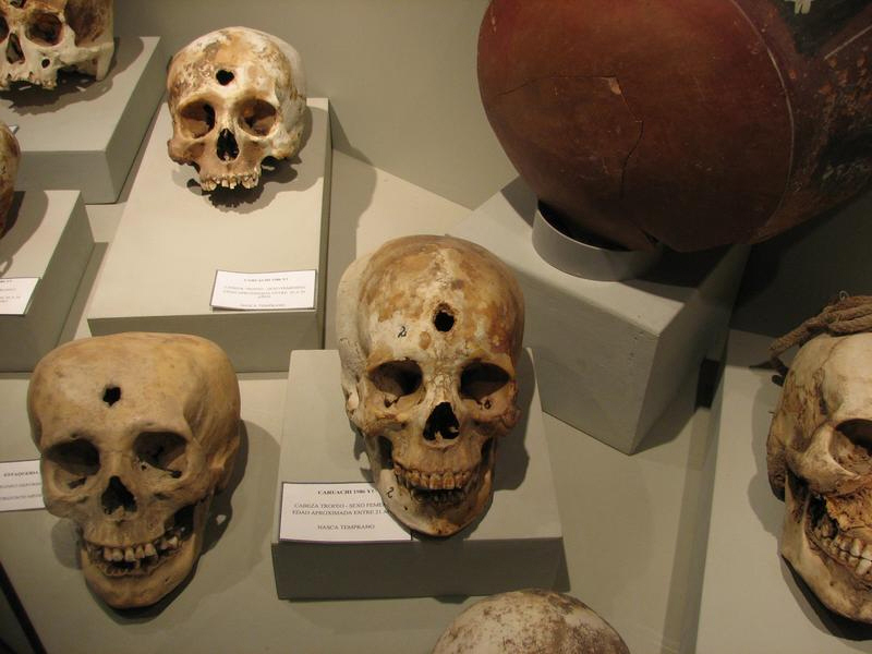 Trophy heads from Nazca, Peru